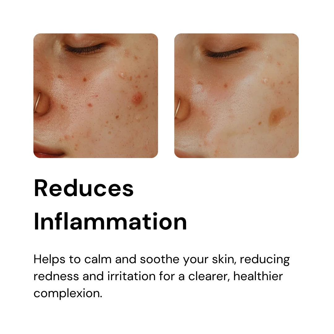 Alpha 101 ayurvedic skin care drop reduces inflammation